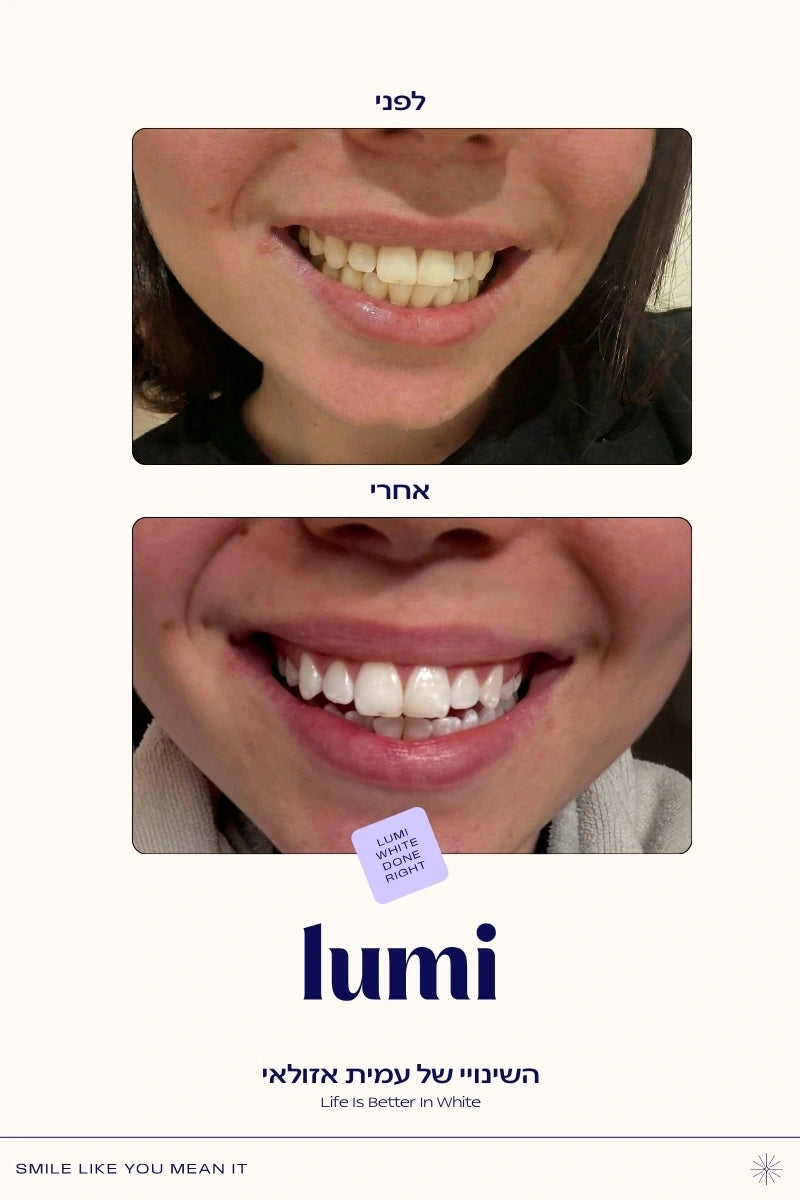 משחה סגולה להלבנת שיניים