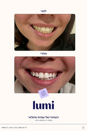 משחה סגולה להלבנת שיניים