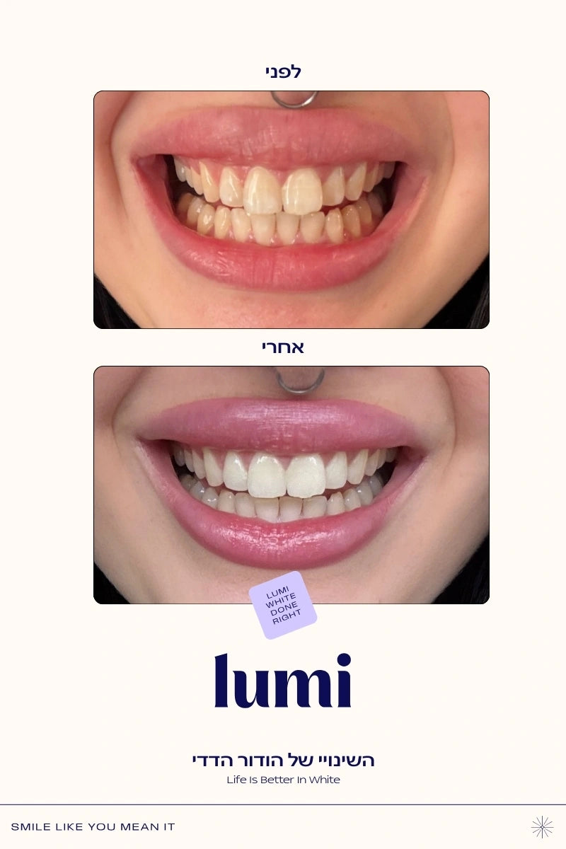 משחה סגולה להלבנת שיניים