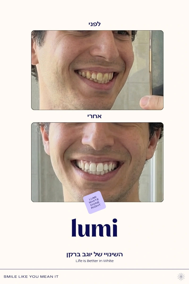 משחה סגולה להלבנת שיניים