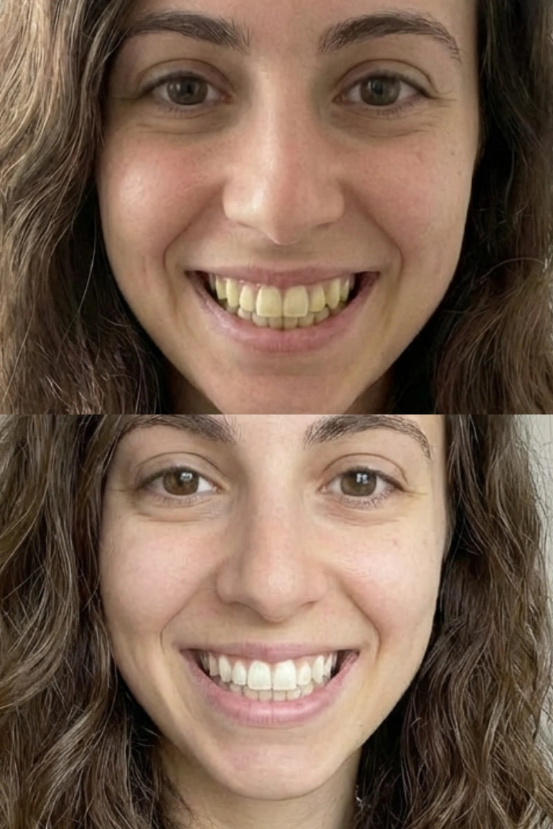 beforeafter-ezgif.com-png-to-webp-converter_22aaf54e-151e-4908-9126-ff84c0e0e157.webp