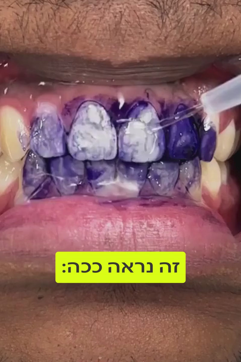 משחה סגולה להלבנת שיניים