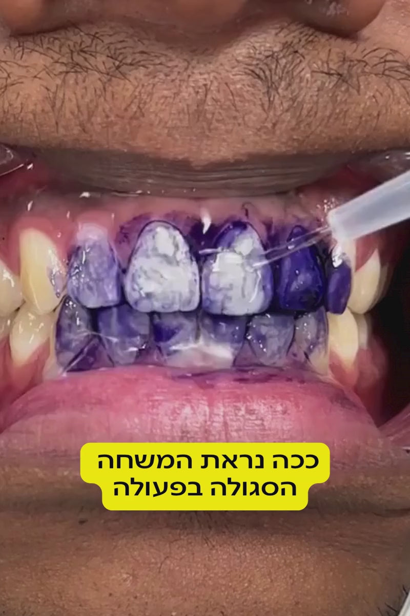 משחה סגולה להלבנת שיניים